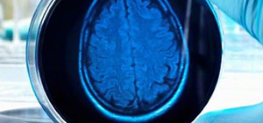cerebro-laboratorio