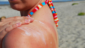 pile-melanoma-sol
