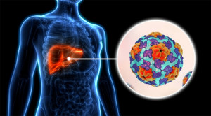 hepatitis-a-imagen